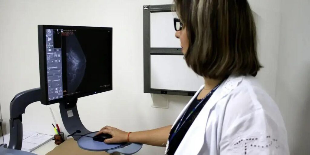 Entidades médicas solicitam ampliação da faixa etária para mamografia