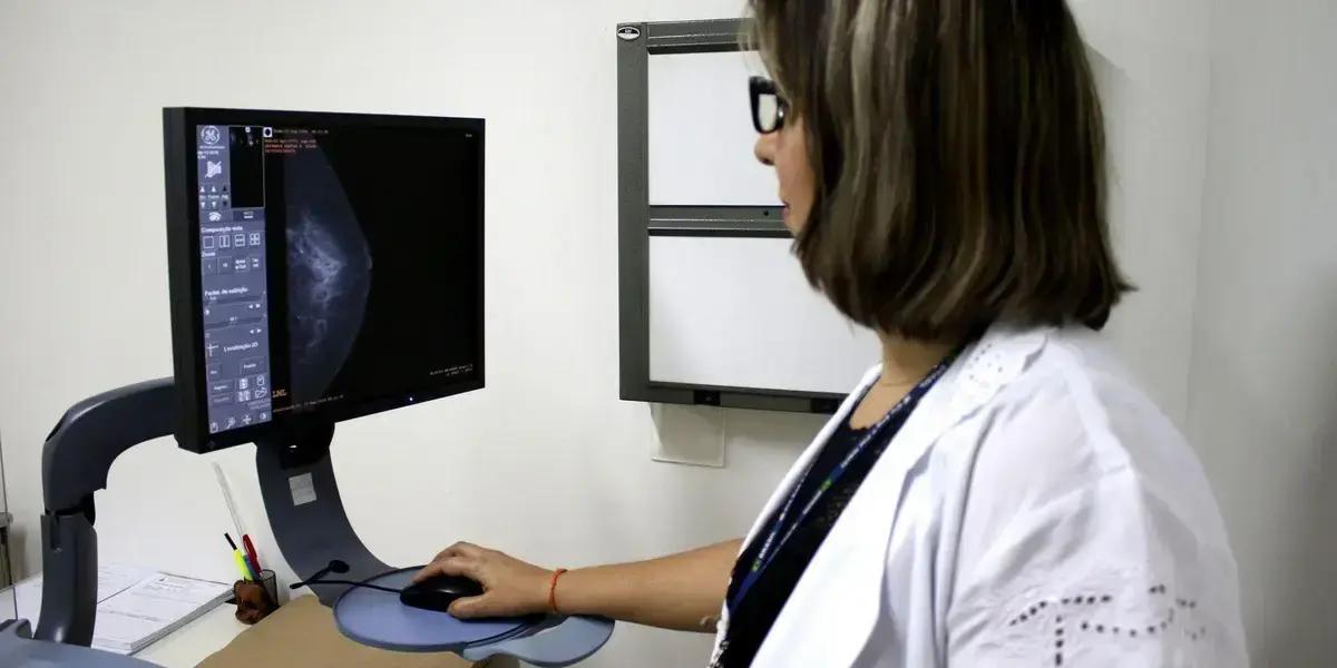 Entidades médicas solicitam ampliação da faixa etária para mamografia