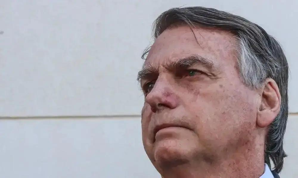 Jair Bolsonaro recebe alta após três semanas de recuperação de cirurgia