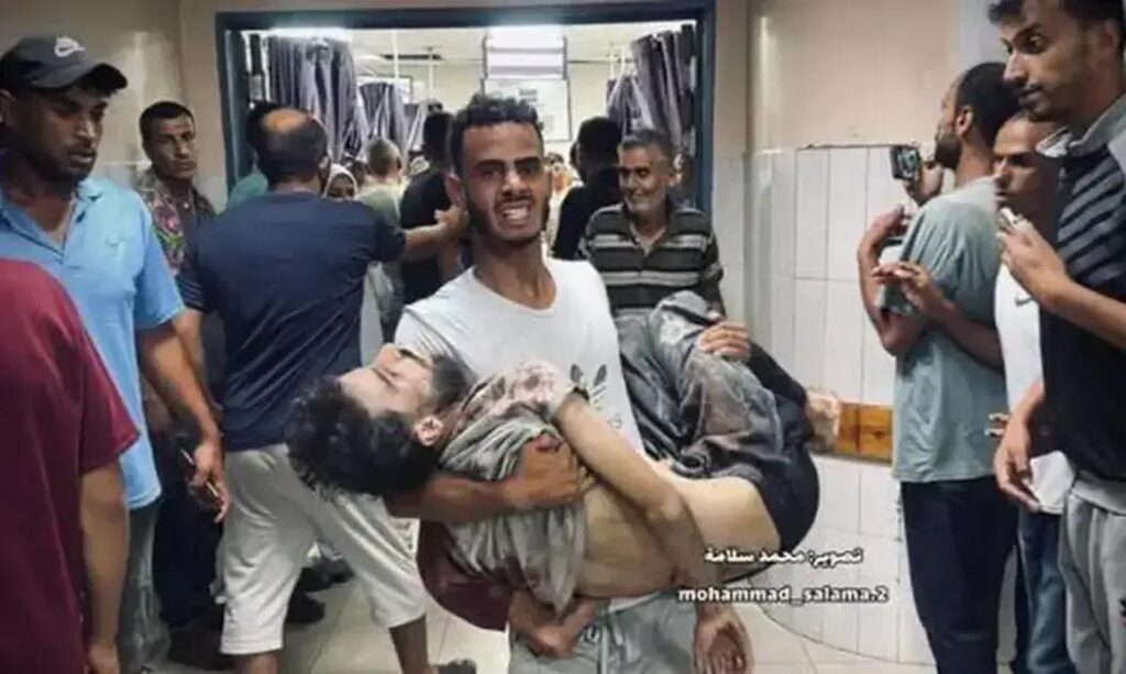 Médicos em Gaza Enfrentam Crise de Fome Enquanto Socorrem Feridos