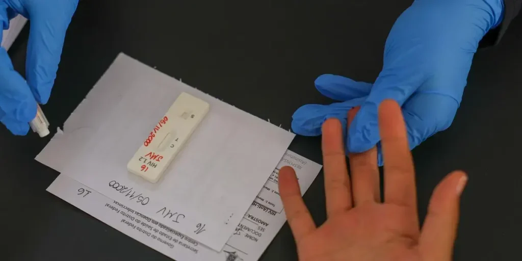 Brasil busca acordos para inclusão da PrEP de longa duração no SUS