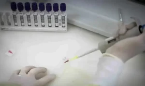 Pacientes em SP: Suspeita de Ebola e confirmação de meningite