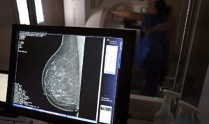 Médicos lançam guia para evitar recusa de mamografia digital
